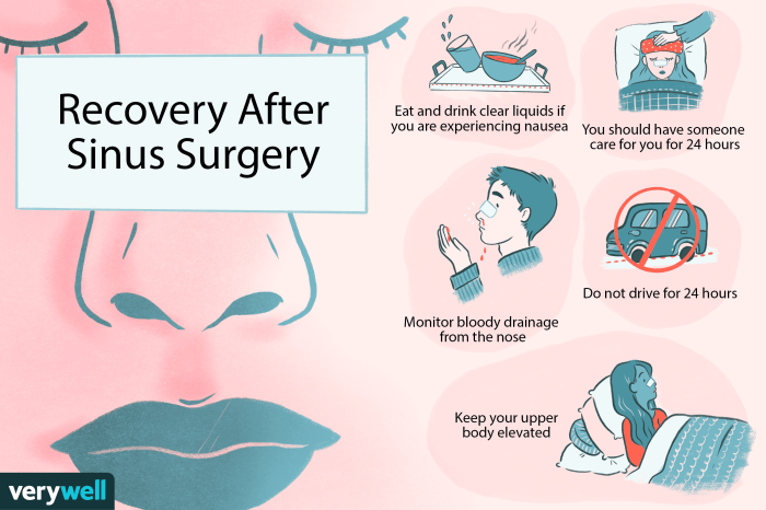 Surgery sinus septoplasty recovery nasal after post operation expect