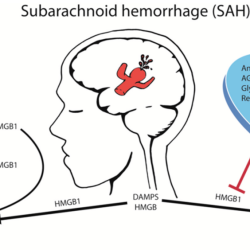 Subarachnoid hemorrhage seizures nursing brain strokes aneurysm icu therapy yahoo search