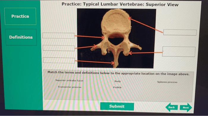 Vertebral column vertebrae lumbar process physiology spinous articular inferior highlighted characterized rounded thick